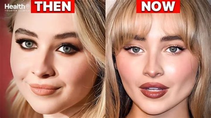 Did Sabrina Carpenter Get Work Done? A Closer Look At Her Transformation
