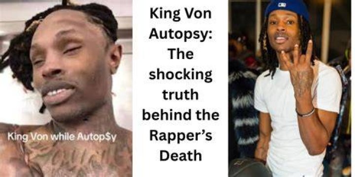 King Von Autopsy: The Shocking Truth Behind His Untimely Death